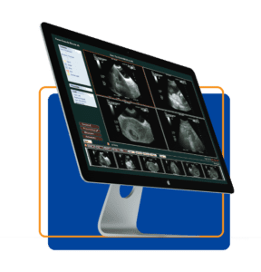 Radiology – Nebras Technology